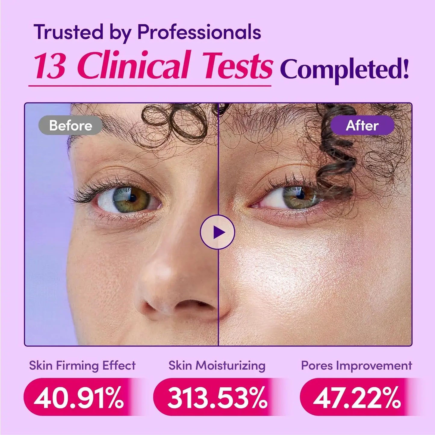 Radiant™ Bakuchiol Plumping Serum